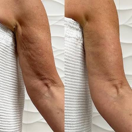 Arm Firming Cream